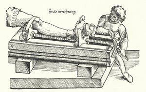 Apparaat voor het rechtzetten van een gewonde been (gravure)