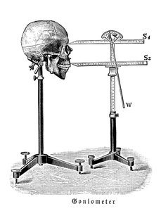 Goniometer meet menselijke schedel