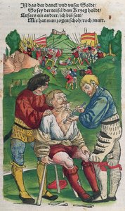 Een pijl verwijderen, illustratie uit Feldtbuch der Wundartzney door Hans von Gersdorff, 1540