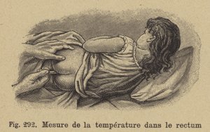 Temperatuur van een kind nemen via het rectum