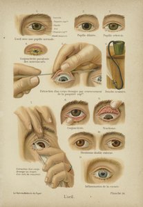 Het oog