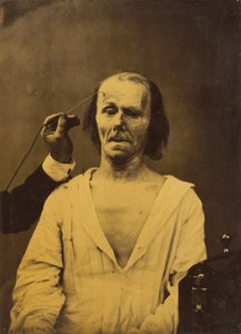 Een ontspannen gezicht (links); Diepe aandacht (rechts),1854-1856, gedrukt 1862 (foto)