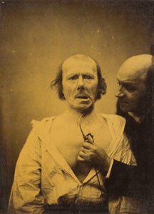 Deze contractie van m. platysma alleen mist expressie,1854-1856, gedrukt 1862 (foto)