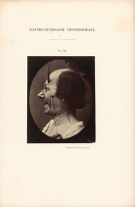 Fotografische elektrofysiologie, Afbeelding 39 door Guillaume Benjamin Duchenne