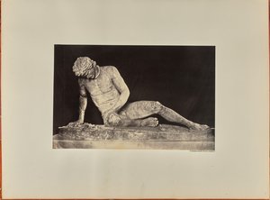 De stervende gladiator, vooraanzicht (Capitool) door James Anderson