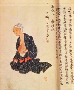 De eerste chirurgische behandeling van borstkanker uitgevoerd onder algemene verdoving door Seishu Hanaoka in 1804 door Japanese School