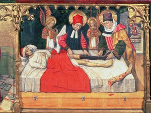 SS. Cosmas en Damian transplanteren het been van een Ethiopische man op de stomp van diaken Justinianus