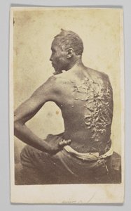 Gordon onder medische inspectie, 1863