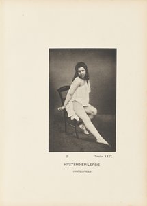 Hystero-epilepsie contractuur door Paul Marie Léon Regnard