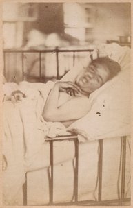 Hysterische epilepsie, permanente contractie, plaat XXVIII uit 