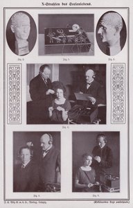 Persoonlijkheidsanalyse met röntgenstralen (zw/w foto)