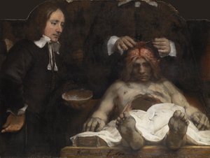 De anatomische les van Dr. Jan Deyman, 1656