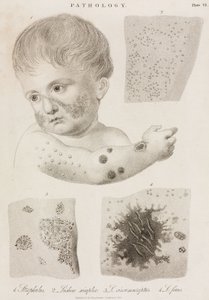 Dermatologie Soorten huidziekten