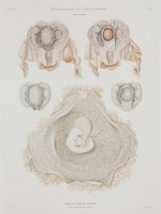 Gynaecologie Menselijke baarmoeder met embryo, ca. 1847-1859 door John Pardon