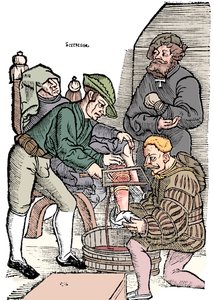 Amputatie van een been zonder verdoving, 1593 door Unbekannt