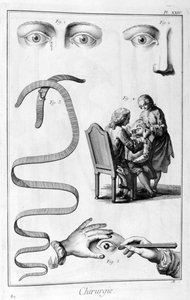 Oogchirurgie, 1751-1777