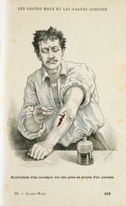 Een wond schilderen met een antiseptische oplossing, ca. 1890