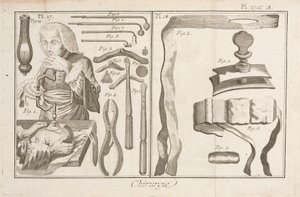 Trepanatie door Unbekannt