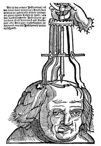 Trepanatie, 1593 door Unbekannt