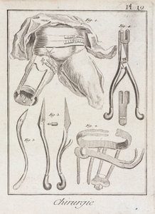 Vroege moderne orthopedische chirurgie door Unbekannt
