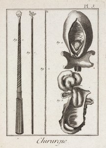 Uitrusting, vroegmoderne chirurgische instrumenten en diagrammen van lichaamsdelen