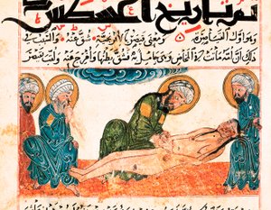 Afbeelding van keizersnede. Miniatuur uit een medisch manuscript van Abu Raihan Al-Biruni (of Alberuni) (973-1048), Perzisch intellectueel en wetenschapper, folio 161.