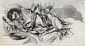 Ongevalgeneeskunde - over de meest effectieve hulp aan drenkelingen - de walnootluiers aan de zijkant en het braken van het water dat hij dronk - gravure in 
