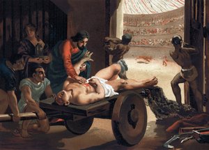 Claude Galien (Klaudios Galenos of Claudio Galeno of Claudius Galenus of Galen, ca. 131 - ca. 201), Griekse arts behandelt een gladiator. Barcelona 1881 door Unknown artist