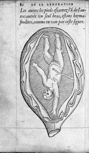 De positie van de foetus in de baarmoeder tijdens de zwangerschap. Gravure uit 