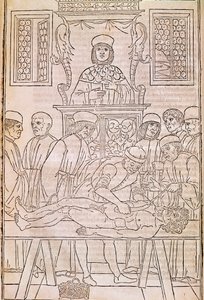 Autopsie. Codex. Het lichaam van een dode man ontleed door artsen voor een anatomische studie. 