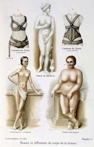 Schoonheid en misvorming van het vrouwenlichaam (mager en obesitas); Juno