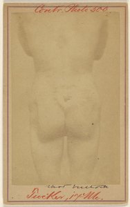 [Jno. E. Tucker, in de billen geschoten, slachtoffer burgeroorlog].