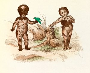 Klein meisje bedekt met harige plekken (gravure)