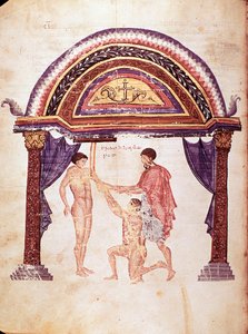 Geneeskunde: reductie van een ontwrichte elleboog, patiënt wordt opgehangen aan de arm (manuscript) door Unknown artist