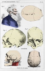 Studie over de morfologie van een misdadigersschedel door de Italiaanse criminoloog
