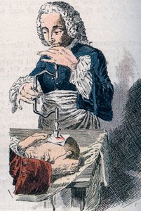 De trepanatie. Prent uit de 18e eeuw. door Unknown artist
