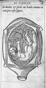 De positie van de foetus in de baarmoeder tijdens de zwangerschap. Gravure uit 