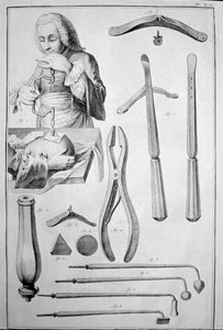Schedeltrepanatie, diverse instrumenten door Unknown artist