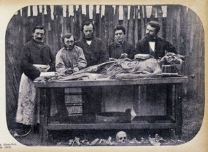 Dissectie, ca. 1865.