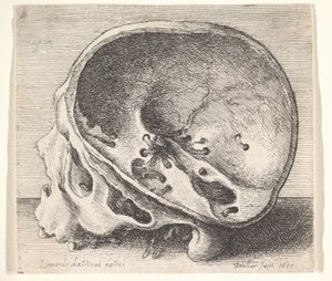 Gesecteerde schedel in profiel naar links met de linkerzijde van de schedel verwijderd, 1651