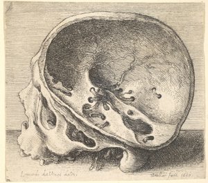 Gesneden schedel in profiel naar links met de linkerzijde van de schedel verwijderd, 1651