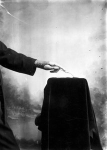 Protheses: man met een prothetische hand