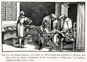 Een Duitse chirurg, uit Troost van Filosofie door Boethius, illustratie uit Wetenschap en Literatuur in de Middeleeuwen en Renaissance, geschreven en gegraveerd door Paul Lacroix, 1878