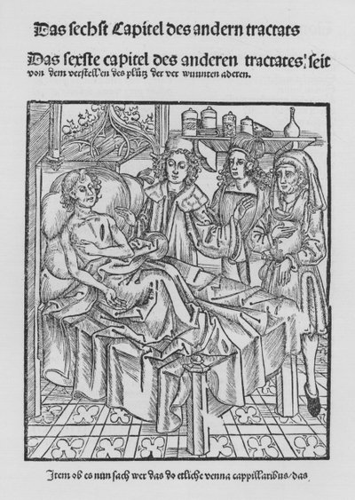 Het Boek van Cirurgia door Hieronymus Brunschwig door (after) German School