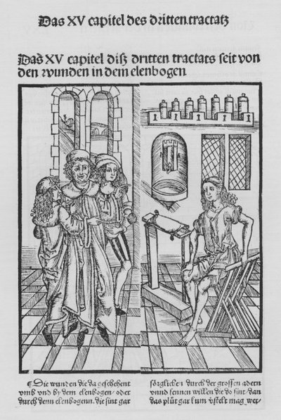 Het boek van Cirurgia door Hieronymus Brunschwig door (after) German School