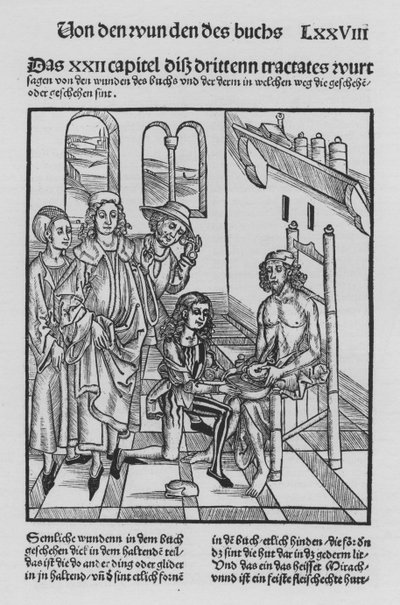 Het boek van Cirurgia door Hieronymus Brunschwig door (after) German School