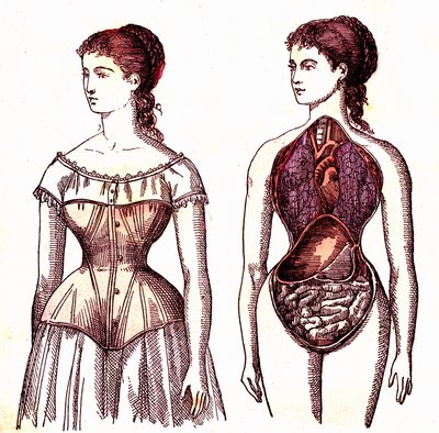 Korsetcompressie - Normaal leven en gezondheid door J. Rengade. Tekening door A. Demarle 1881 door Alphonse Demarle