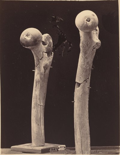 Specimens van Schotwonden aan het Dijbeen door American 19th Century