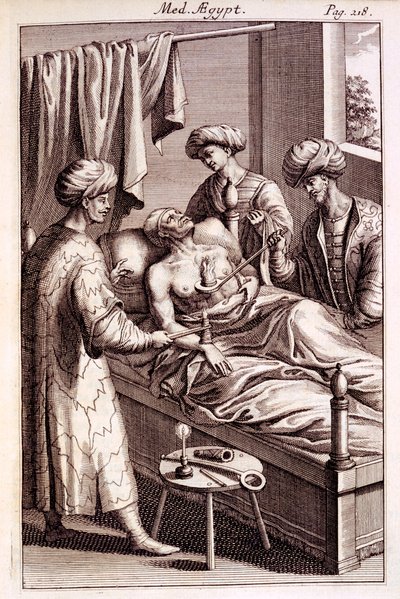 Illustratie van moxibustie uit Medicina Aegyptorum door Prospero Alpinus, 1745 door American School