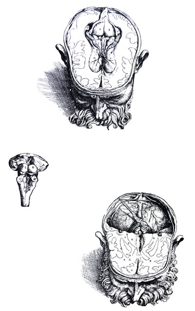 De platen uit het zevende boek van de De Humani Corporis Fabrica door Andreas Vesalius
